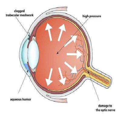 Doctor performing cataract examination